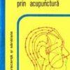 Tratamentul prin acupunctura