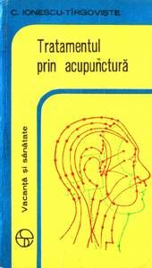 Tratamentul prin acupunctura