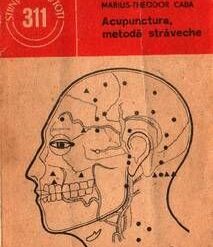 Acupunctura