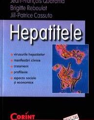 Cardiopatia ischemica