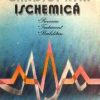 Cardiopatia ischemica