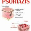 Tratamente pentru Psoriazis