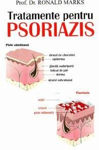 Tratamente pentru Psoriazis