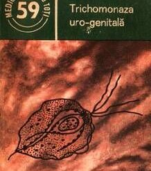 Trichomonaza uro-genitala