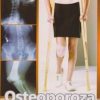 OSTEOPOROZA