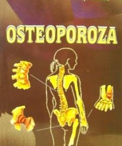 OSTEOPOROZA