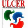 Totul despre ulcer